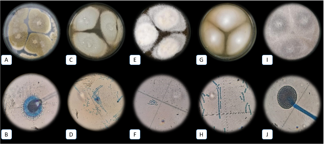 Características fenotípicas de los hongos aislados de los
granos de café. Aspergillus spp. en CYA (A), vesícula y conidias características de Aspergillus spp. a 100x (B),  Penicillium spp. en
MEA (C), métula, fiálide y conidias
características de Penicillium spp. a 40x (D), Fusarium spp. en CLA (E) fiálides y macroconidias de Fusarium spp.
características a 40x (F),  Geotrichum spp. en
MEA (G), artroconidias características de Geotrichum spp.  a 100x (H), Mucor spp. en MEA (I) y su esporangio y
esporangiosporas características a 100x (J).